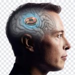 Elon Musk Neuralink, Elon Musk, Elon Musk Neuralink PNG, Elon, Neuralink PNG, Neuralink implant, Neuralink brain chip, brain chip, tesla, space x, PNG, PNG Images, Transparent Files, png free, png file, Free PNG, png download,