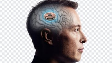 Elon Musk Neuralink, Elon Musk, Elon Musk Neuralink PNG, Elon, Neuralink PNG, Neuralink implant, Neuralink brain chip, brain chip, tesla, space x, PNG, PNG Images, Transparent Files, png free, png file, Free PNG, png download,