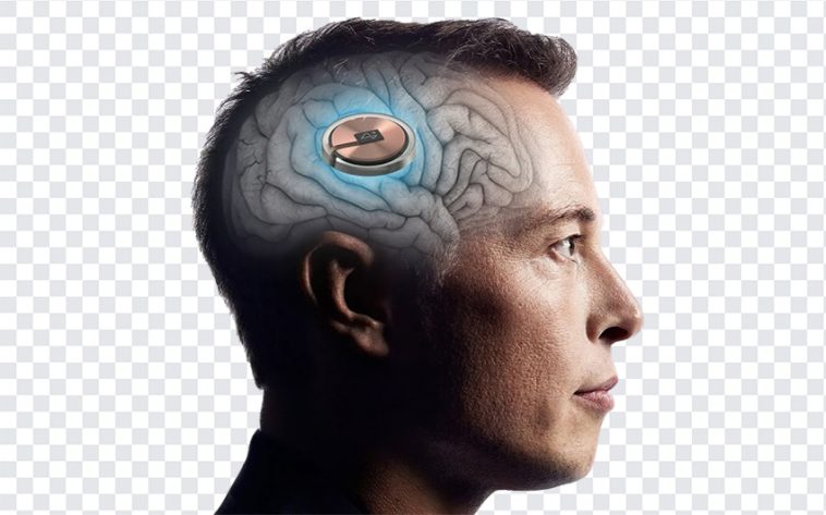 Elon Musk Neuralink, Elon Musk, Elon Musk Neuralink PNG, Elon, Neuralink PNG, Neuralink implant, Neuralink brain chip, brain chip, tesla, space x, PNG, PNG Images, Transparent Files, png free, png file, Free PNG, png download,